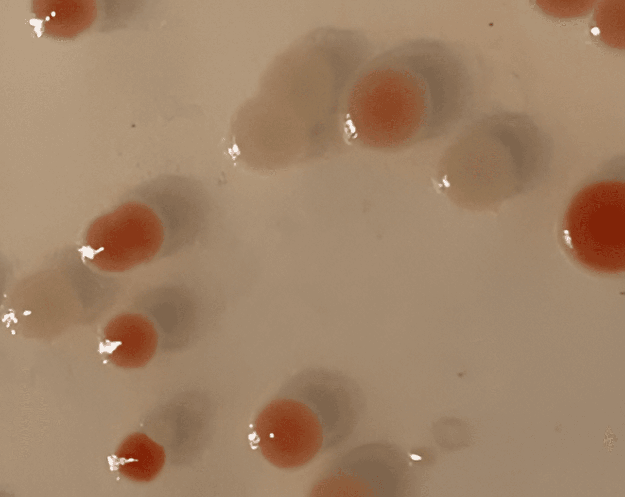 Lycopene-producing E. coli colonies — 14-fragment pathway assembled with F1-X™